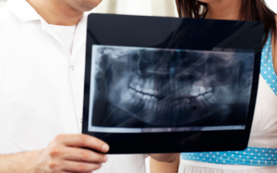 3 Reasons Dental Implants Are A Fantastic Investment