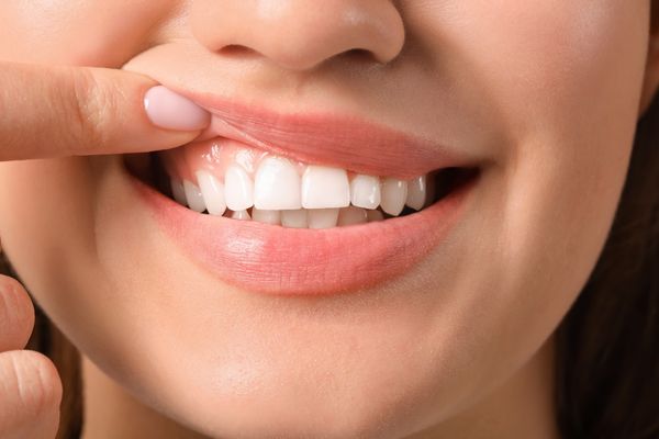 How To Take Care Of Your Gums Bakersfield Dentist